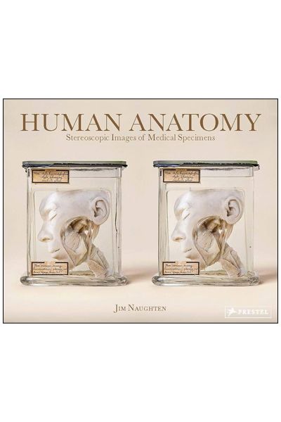 Human Anatomy : Stereoscopic Images of Medical Specimens